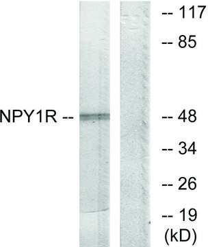 Anti-NPY1R antibody produced in rabbit affinity isolated antibody