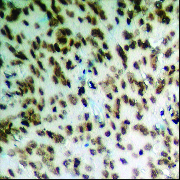 Anti-phospho-HDAC2 (pSer394) antibody produced in rabbit affinity isolated antibody