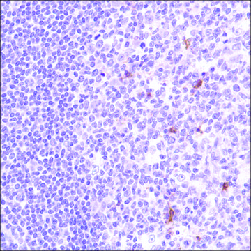 Anti-Cleaved PTEN antibody, Rabbit monoclonal clone SP227, recombinant, expressed in proprietary host, affinity isolated antibody