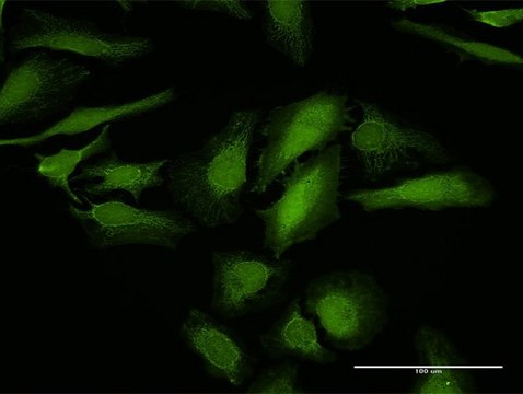 Anti-LGALS1 antibody produced in rabbit purified immunoglobulin, buffered aqueous solution