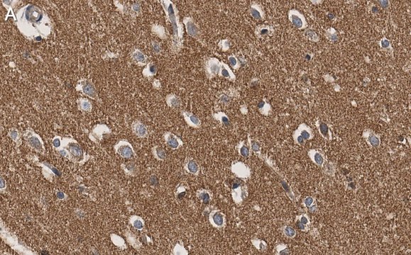 Anti-RhoB Antibody, clone 3M19 ZooMAb&#174; Rabbit Monoclonal recombinant, expressed in HEK 293 cells