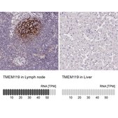 Anti-TMEM119 antibody produced in rabbit Prestige Antibodies&#174; Powered by Atlas Antibodies, affinity isolated antibody, buffered aqueous glycerol solution