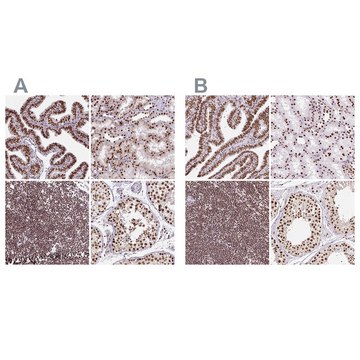 Anti-XRCC6 antibody produced in rabbit Prestige Antibodies&#174; Powered by Atlas Antibodies, affinity isolated antibody, buffered aqueous glycerol solution