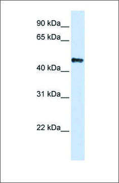 Anti-CSDA antibody produced in rabbit affinity isolated antibody