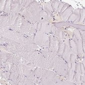 Anti-MCOLN3 antibody produced in rabbit Prestige Antibodies&#174; Powered by Atlas Antibodies, affinity isolated antibody, buffered aqueous glycerol solution
