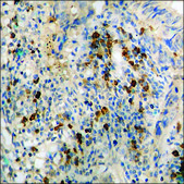 Anti-phospho-PDGF Receptor &#946; (pTyr751) antibody produced in rabbit affinity isolated antibody