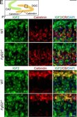 Anti-Calretinin Antibody, clone 6B8.2 clone 6B8.2, Chemicon&#174;, from mouse