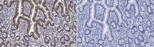 Anti-ATM Antibody, clone 4N19, ZooMAb&#174; Rabbit Monoclonal recombinant, expressed in HEK 293 cells