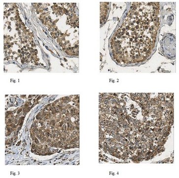 Anti-DHODH Antibody from rabbit, purified by affinity chromatography