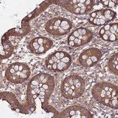 Anti-PFDN6 antibody produced in rabbit Prestige Antibodies&#174; Powered by Atlas Antibodies, affinity isolated antibody, buffered aqueous glycerol solution