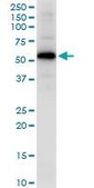 Anti-GYG2 antibody produced in rabbit purified immunoglobulin, buffered aqueous solution