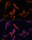 Anti-IL18 antibody produced in rabbit