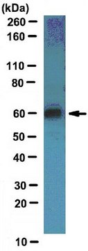 Anti-GABA(A) receptor subunit gamma-2 Antibody serum, from rabbit