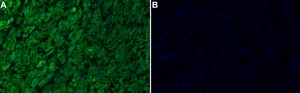 Anti-S100A1 Antibody, clone 1D18 ZooMAb&#174; Rabbit Monoclonal recombinant, expressed in HEK 293 cells
