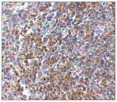 Anti-GPR Antibody3 from rabbit, purified by affinity chromatography