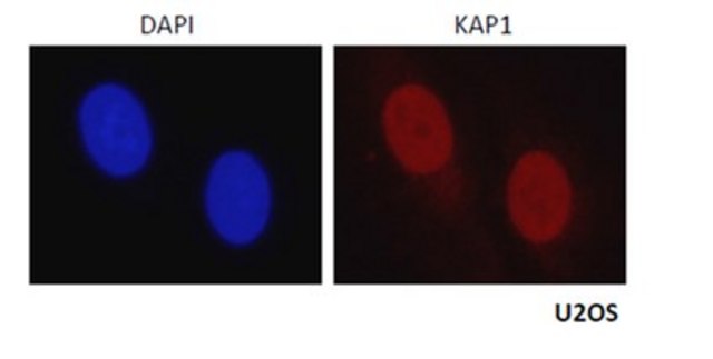 Anti-KAP-1/TRIM28 Antibody serum, from rabbit