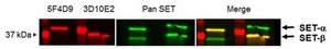 Anti-SET-beta, clone 3D10E2 clone 3D10E2, from mouse