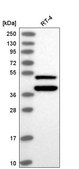 Anti-FOXO4 antibody produced in rabbit Prestige Antibodies&#174; Powered by Atlas Antibodies, affinity isolated antibody