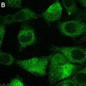 Anti-TMEM206 Antibody, clone 2H13 ZooMAb&#174; Rabbit Monoclonal recombinant, expressed in HEK 293 cells