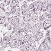 Anti-SFRP4 antibody produced in rabbit Prestige Antibodies&#174; Powered by Atlas Antibodies, affinity isolated antibody, buffered aqueous glycerol solution