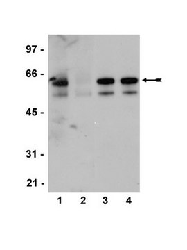 Anti-phospho-Src family (Tyr416) Antibody, clone 2N8, rabbit monoclonal clone 2N8, Upstate&#174;, from rabbit