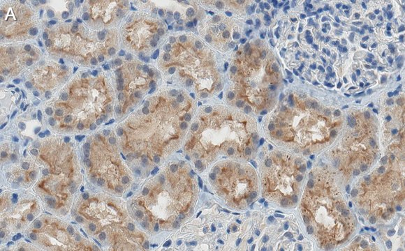 Anti-SLC5A2 Antibody, clone 2I4 ZooMAb&#174; Rabbit Monoclonal recombinant, expressed in HEK 293 cells