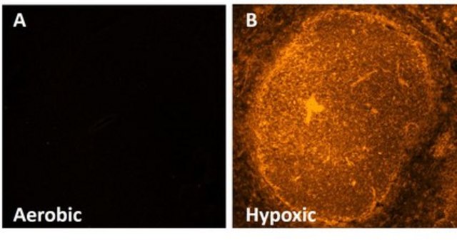 Anti-EF5 Antibody, clone ELK3-51 Antibody, Cyanine 3 conjugate clone ELK3-51, from mouse, CY3 conjugate