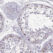 Anti-MAGEC1 antibody produced in rabbit Prestige Antibodies&#174; Powered by Atlas Antibodies, affinity isolated antibody, buffered aqueous glycerol solution