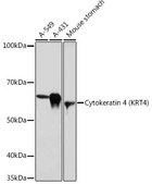Anti-Cytokeratin 4 (KRT4) Antibody, clone 6H9R6, Rabbit Monoclonal