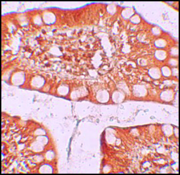 Anti-TFF3 antibody produced in rabbit affinity isolated antibody, buffered aqueous solution