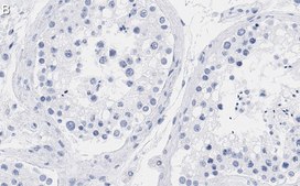 Anti-mTOR Antibody, clone 4O5 ZooMAb&#174; Rabbit Monoclonal recombinant, expressed in HEK 293 cells