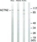 Anti-Actinin &#945; antibody produced in rabbit affinity isolated antibody