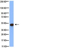 Anti-Tubulin Antibody, beta, clone KMX-1 clone KMX-1, Chemicon&#174;, from mouse