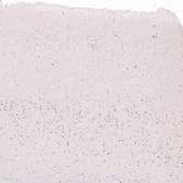 Monoclonal Anti-FOXP2 antibody produced in mouse Prestige Antibodies&#174; Powered by Atlas Antibodies, clone CL5310, purified immunoglobulin, buffered aqueous glycerol solution