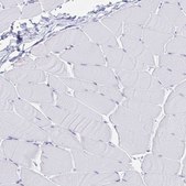 Anti-JCHAIN antibody produced in rabbit Prestige Antibodies&#174; Powered by Atlas Antibodies, affinity isolated antibody, buffered aqueous glycerol solution