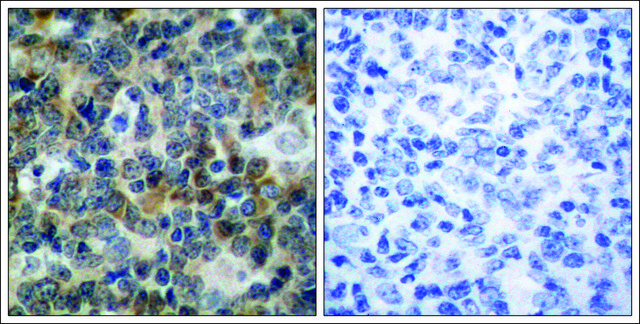 Anti-phospho-VASP (pSer239) antibody produced in rabbit affinity isolated antibody