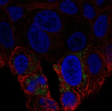 Anti-UCP2 antibody produced in rabbit Prestige Antibodies&#174; Powered by Atlas Antibodies, affinity isolated antibody