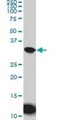Monoclonal Anti-AQP8 antibody produced in mouse clone 1A1, purified immunoglobulin, buffered aqueous solution