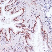 Anti-Acetyl-Histone H3-K9/K14/K18/K23/K27 antibody produced in rabbit