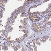 Anti-MIA3 antibody produced in rabbit Prestige Antibodies&#174; Powered by Atlas Antibodies, affinity isolated antibody, buffered aqueous glycerol solution