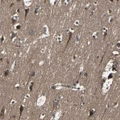Anti-RAB7A antibody produced in rabbit Prestige Antibodies&#174; Powered by Atlas Antibodies, affinity isolated antibody, buffered aqueous glycerol solution