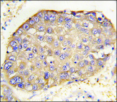 Anti-LECT2 (C-term) antibody produced in rabbit affinity isolated antibody, buffered aqueous solution