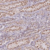 Anti-CHMP4B antibody produced in rabbit Prestige Antibodies&#174; Powered by Atlas Antibodies, affinity isolated antibody, buffered aqueous glycerol solution