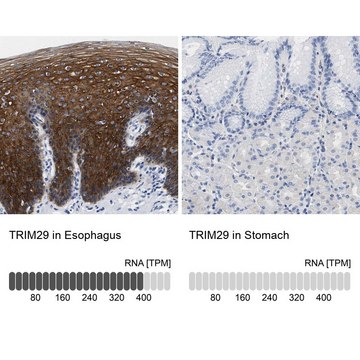 Anti-TRIM29 antibody produced in rabbit Prestige Antibodies&#174; Powered by Atlas Antibodies, affinity isolated antibody, buffered aqueous glycerol solution