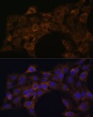 Anti-FoxO3a antibody produced in rabbit