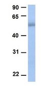 Anti-PLAG1 antibody produced in rabbit affinity isolated antibody