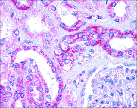 Anti-SIPA1L1 antibody produced in rabbit affinity isolated antibody