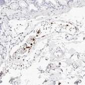 Anti-CAMP antibody produced in rabbit Prestige Antibodies&#174; Powered by Atlas Antibodies, affinity isolated antibody, buffered aqueous glycerol solution