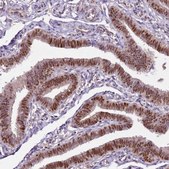 Anti-GSTO2 antibody produced in rabbit Prestige Antibodies&#174; Powered by Atlas Antibodies, affinity isolated antibody, buffered aqueous glycerol solution