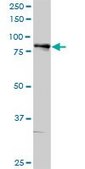 Anti-ALOX5 antibody produced in rabbit purified immunoglobulin, buffered aqueous solution
